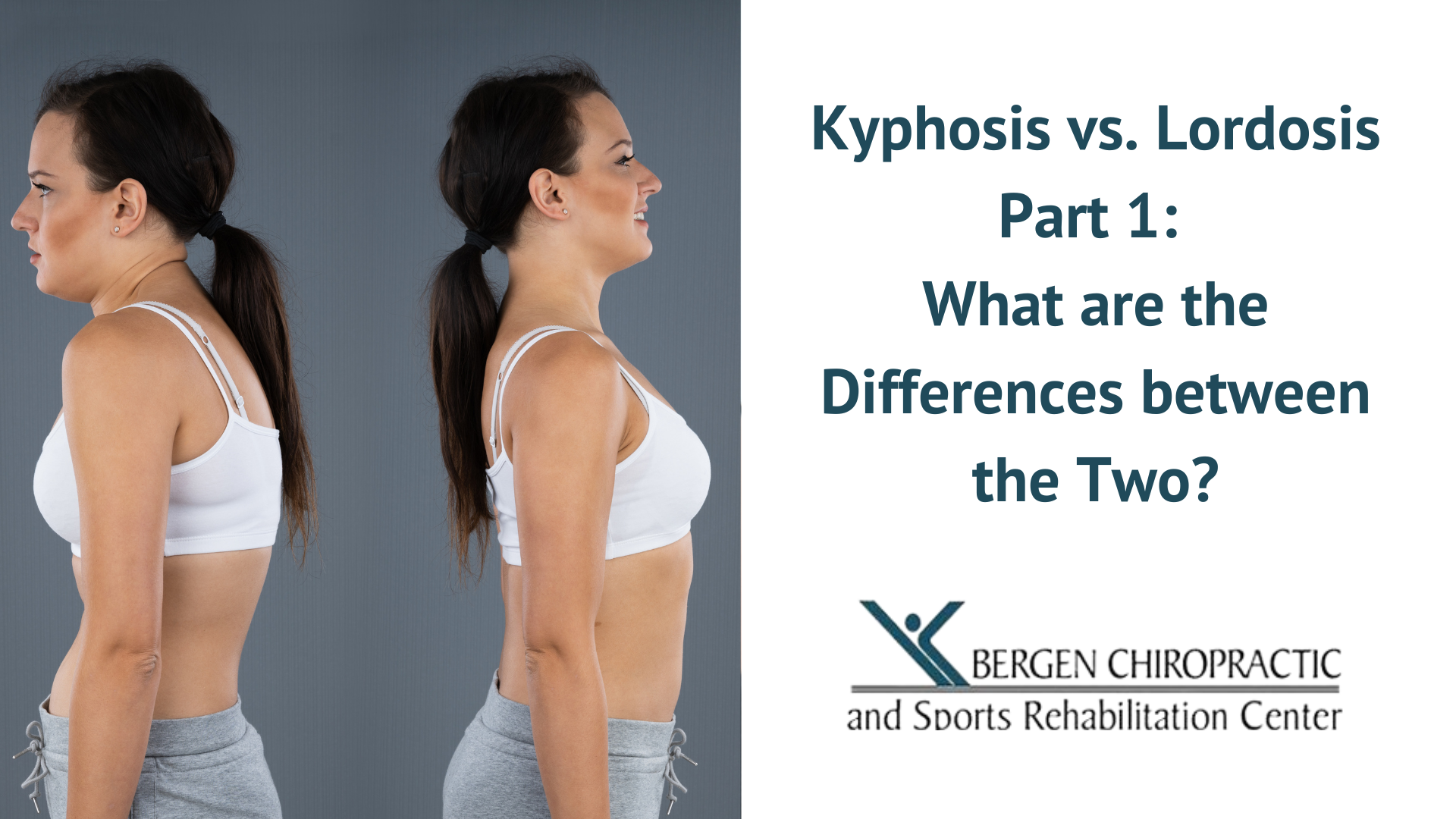 Kyphosis Vs Lordosis Similarities And Differences 