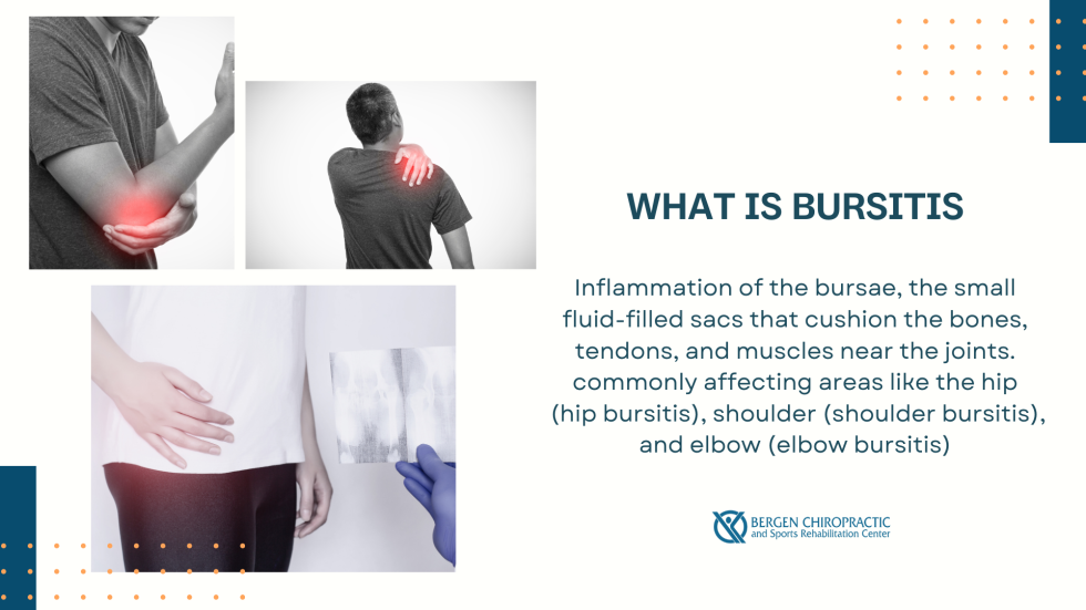 Can a Chiropractor Help with Bursitis?
