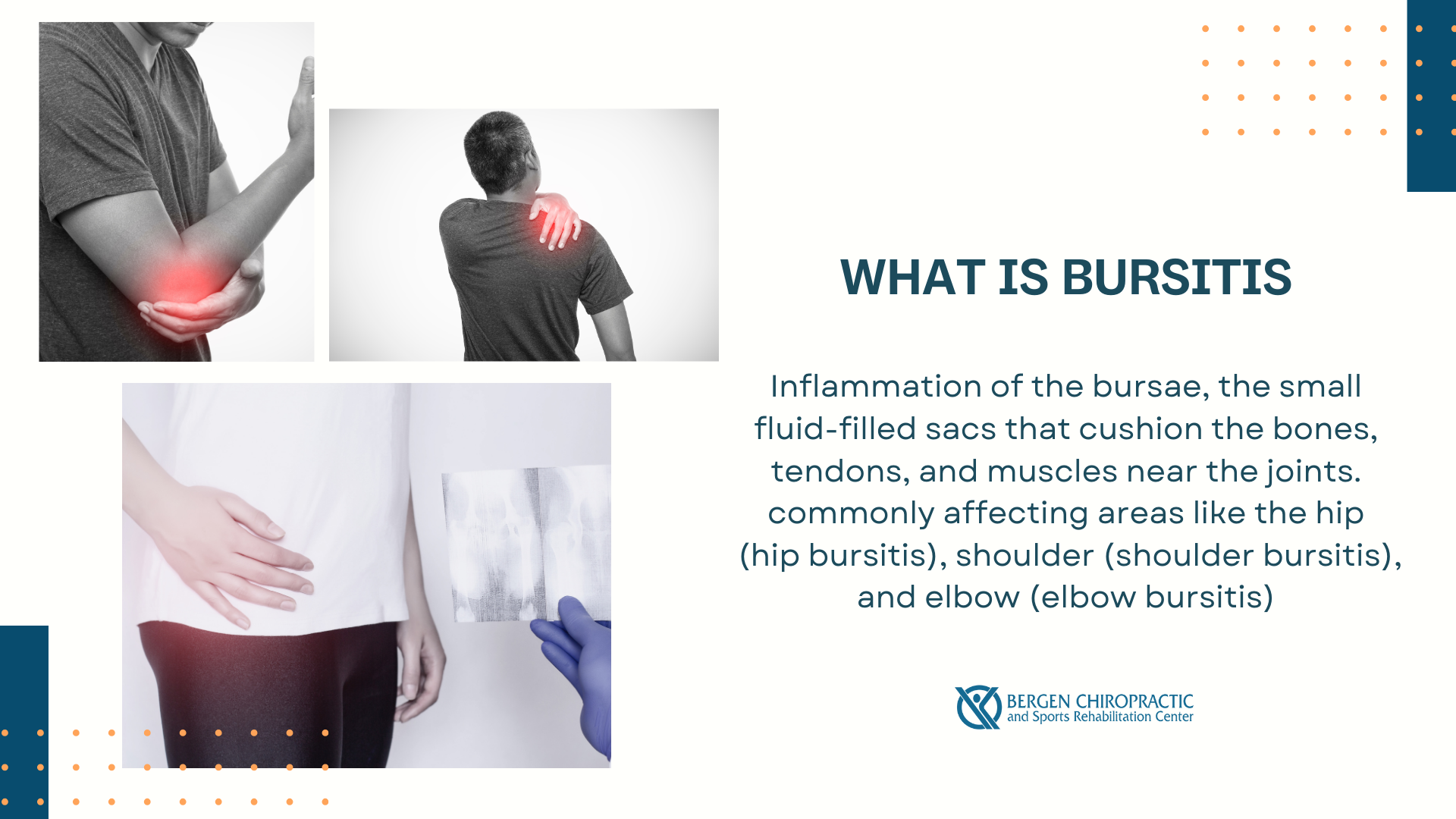 what is bursitis