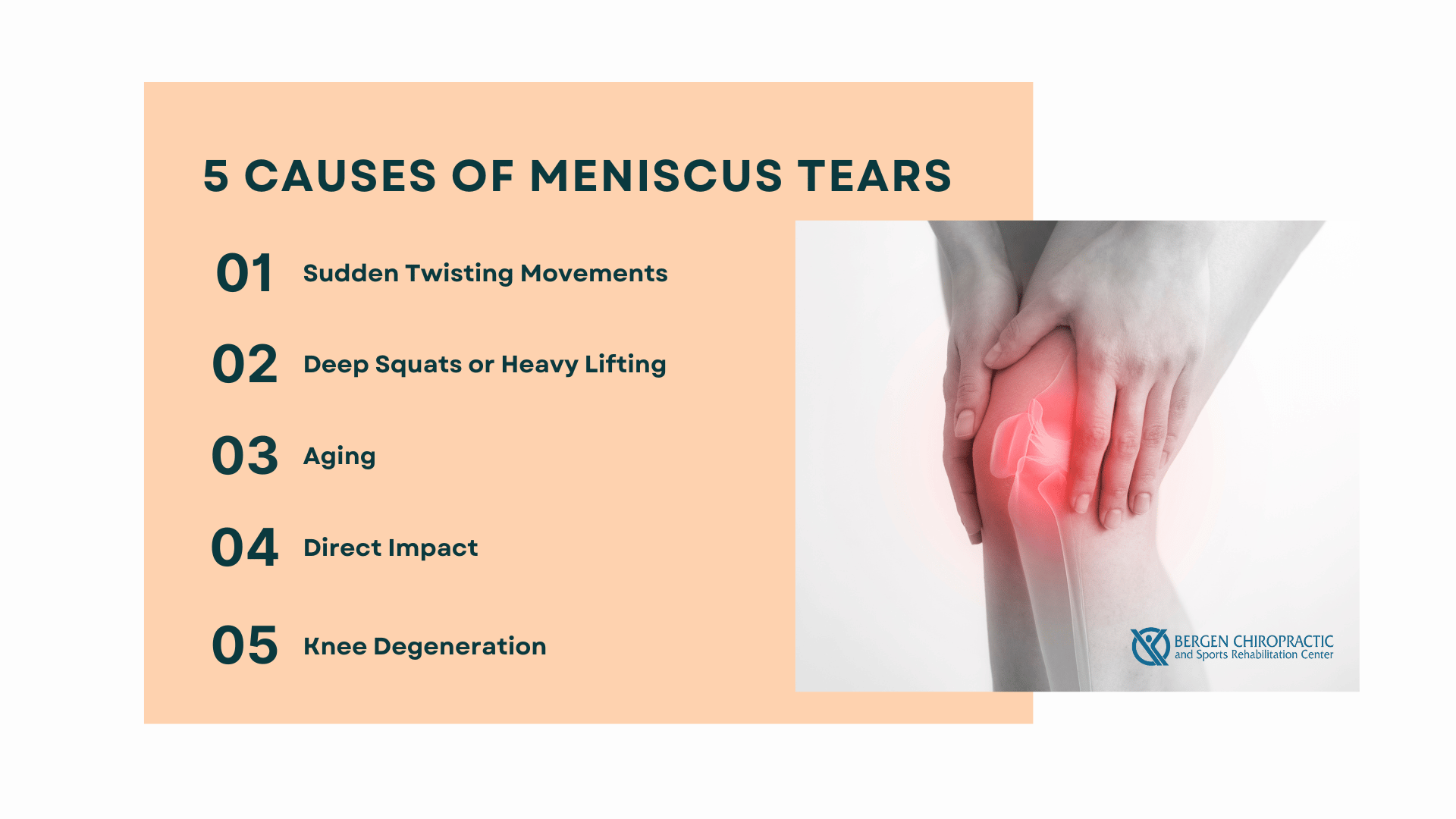 This infographic details 5 causes of meniscus tears