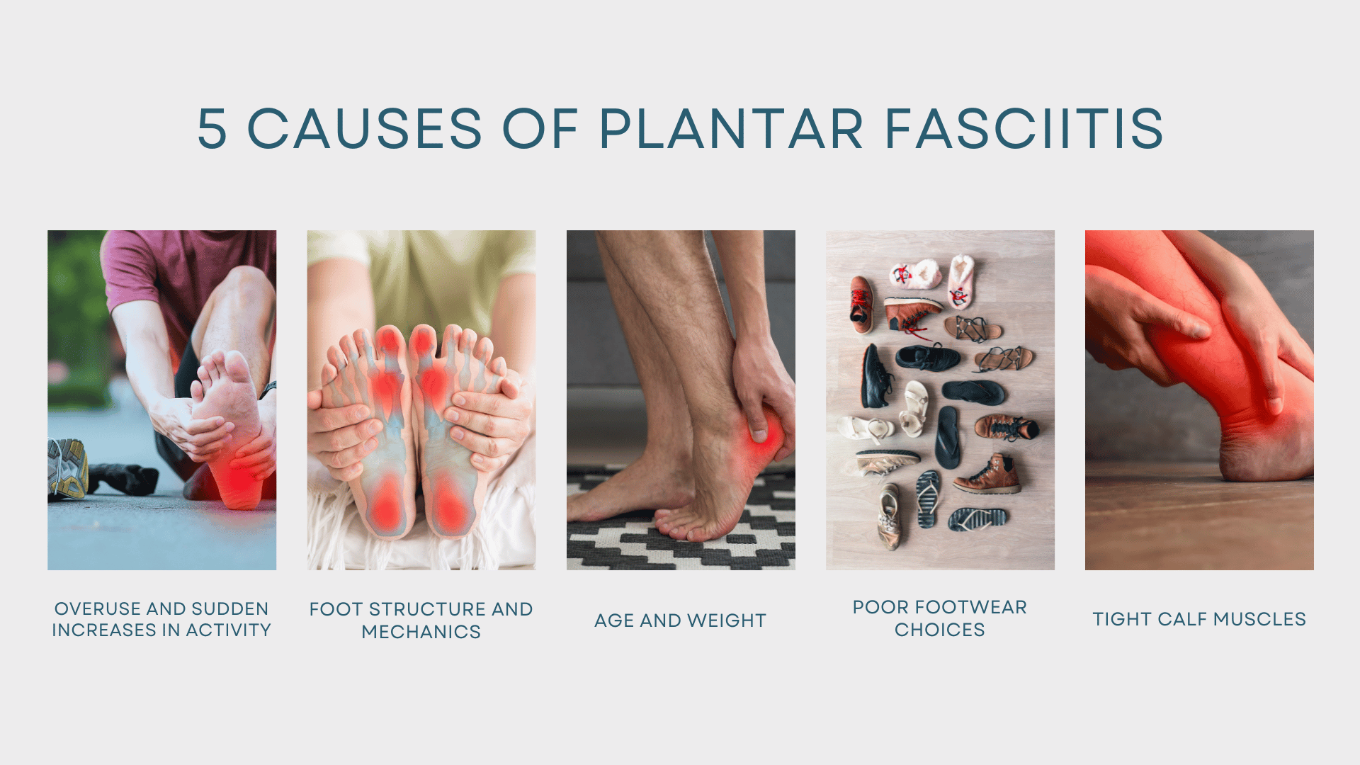 5 causes of plantar fasciitis